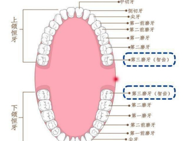 智齿：到底是 “智慧牙” 还是 “麻烦制造者”？